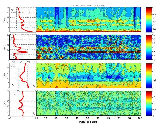 Visual transform of an EEG