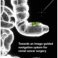 PhD Defence Roeland Eppenga | Towards an image-guided navigation system for rectal cancer