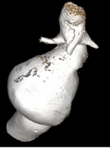 3D model of aorta
