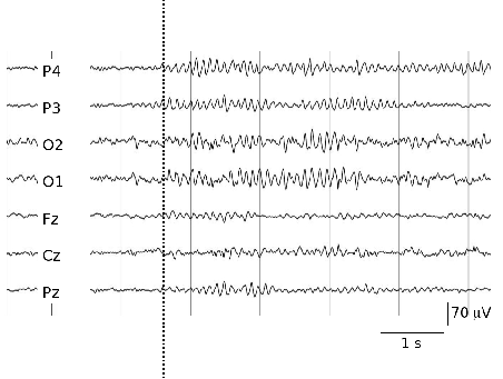 Part of an EEG