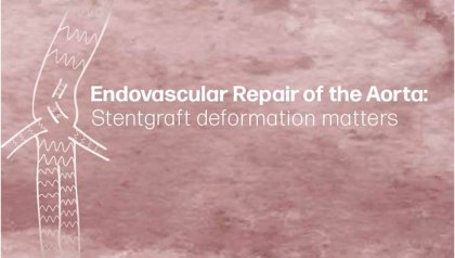 Promotie Jaimy Simmering | Endovascular Repair of the Aorta: Stentgraft deformation matters