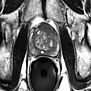 from (PDF) fastMRI: An Open Dataset and Benchmarks for Accelerated MRI (researchgate.net), Using MRI for Prostate Cancer Diagnosis Equals or Beats Current Standard | Imaging Technology News (itnonline.com)
https://www.researchgate.net/publication/329115954_fastMRI_An_Open_Dataset_and_Benchmarks_for_Accelerated_MRI