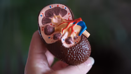 Kidney model