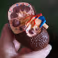 University of Twente and partners start research into biohybrid artificial kidneys