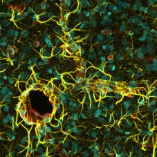 http://www.utwente.nl/ewi/bios/education/masterprojects/Blood%20Brain%20Barrier%20on%20Chip/Blood%20Brain%20Barrier%20on%20Chip-1.jpg