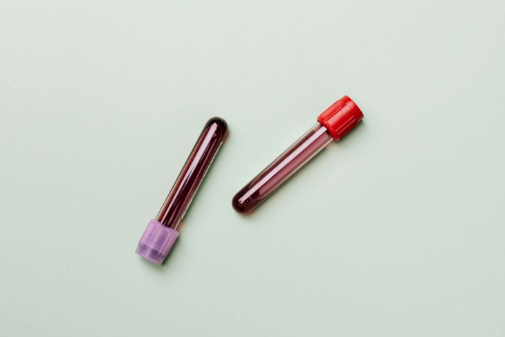 Two vials with blood donated for research