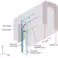BrainGain: Targeting the brain with DBS in Parkinson’s disease