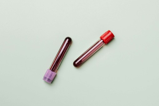 Two vials with blood donated for research